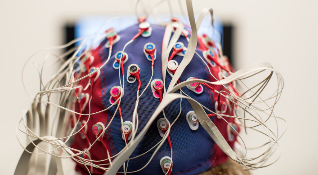 Photo of a head wearing a cap with electrodes, taken from behind.